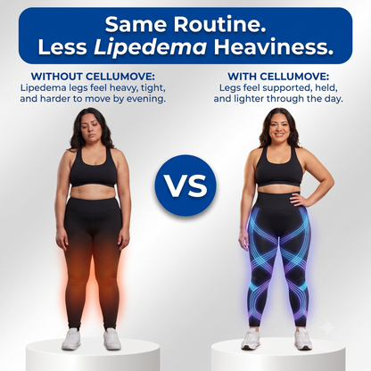 Cellumove 3D legging - say goodbye to lipedema pain and swelling naturally